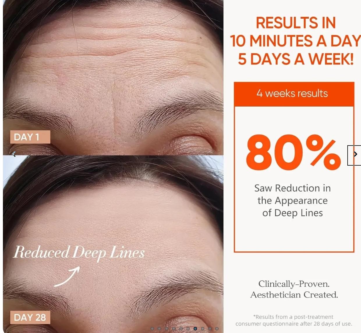Before-and-after skincare results graphic showing a woman's forehead with crow's feet and deep lines reduced over 28 days. The left side shows Day 1 and Day 28 close-ups of the forehead, and the right side contains promotional text stating results in 10 minutes a day, 5 days a week, and 80% reduction in the appearance of deep lines.