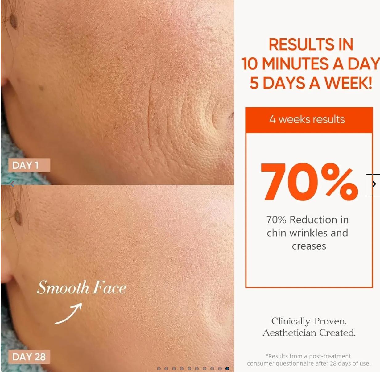 Before-and-after skin comparison showing the side of a face, with Day 1 showing deep wrinkles and creases and Day 28 showing a smoother, more relaxed face. Text on the right states results in 10 minutes a day, 5 days a week, with 70% reduction in chin wrinkles and creases.